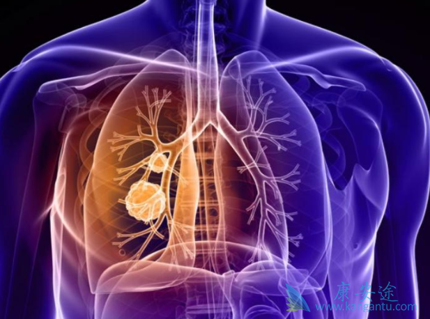 �ΰ������ܻ���