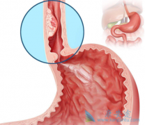 ����Сϸ���ΰ��������ỹ������ʳ���۰�