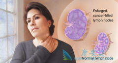 Cereblon���׵��ڼ�Avadomide�����������ܰ������ߵ�Ч����ô����