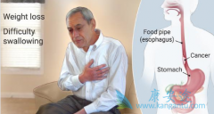 ʳ����/ʳ�ܰ����Եķ�������Ҫ��Ů�Ը���