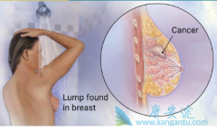 �������ٰ�����HER2�������ٰ�������