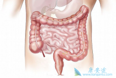 ��ʳ�ṹ��������ȱ���˶��ǵ��½᳦���߷�����Ҫ����