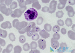 űԭ������ܹ�������֢��űԭ��������֢������