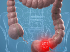 ��ֱ��������ֱ������᳦���������͵İ�֢