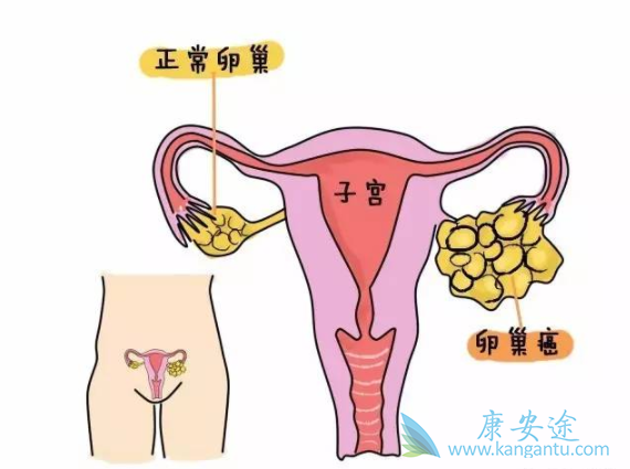 �ѳ�������