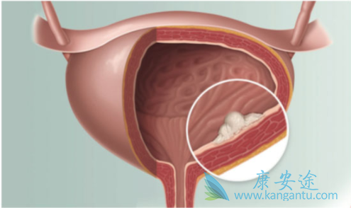 ���װ�������֢״