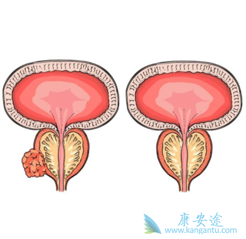 ǰ���ٰ���ת��