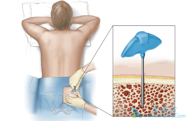 ��Ѫ��������ֲ