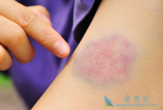 ��Ѫ��ǰ��