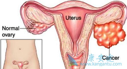 �ѳ�������