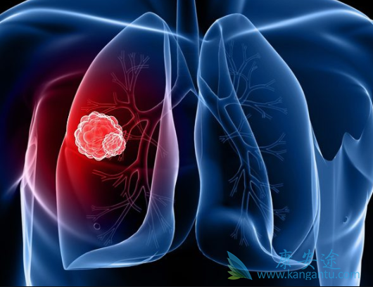 �ΰ�������