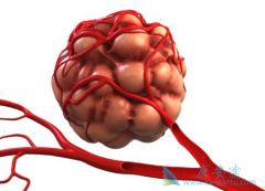 ʲô���ݸ��������ݸ�������ʲô֢״��