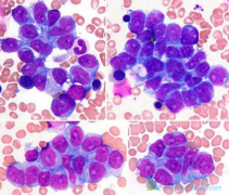 �����Զ෢�Թ����������еĸ����ã�