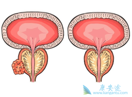 ǰ���ٰ�֢״