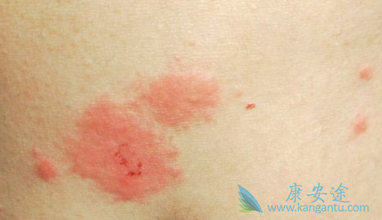 Ƥ����ô����