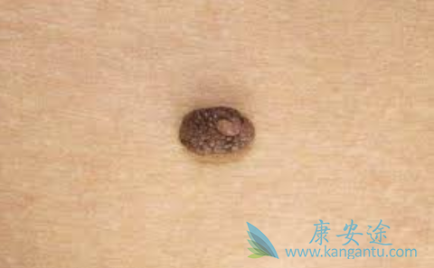 Ƥ������