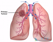 �ΰ����ƻ���ֶ��������𣿾��帱���ö�����Щ��