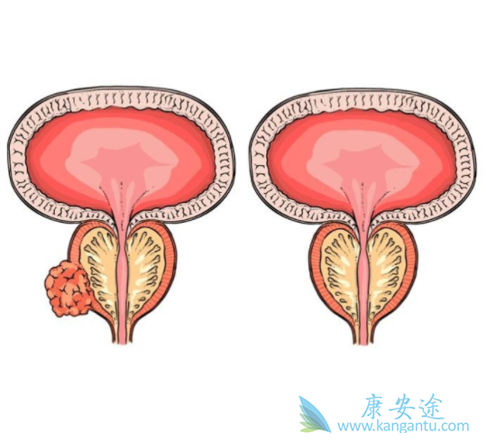 ǰ���ٰ�����