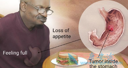 ����θ��