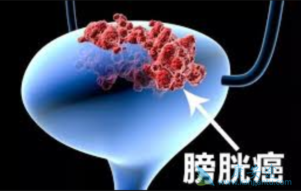 ���װ�����