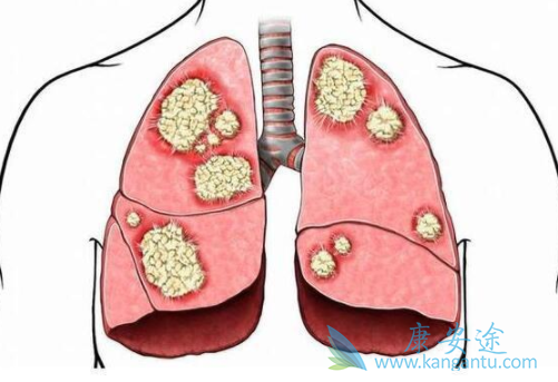 �ΰ�����