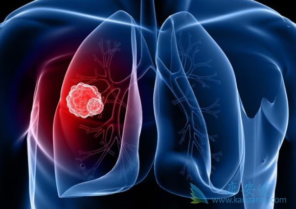 �ΰ�����