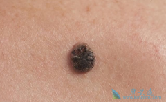 ��ķ�������ϵͼ�����ƥľ����һ���������ں�ɫ������Ч