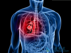 EGFR���Ƽ�����ɳ���Ϸ�������߷ΰ���ת�Ʋ����������