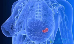 ���������շ����ٰ���ԭ������Щ��