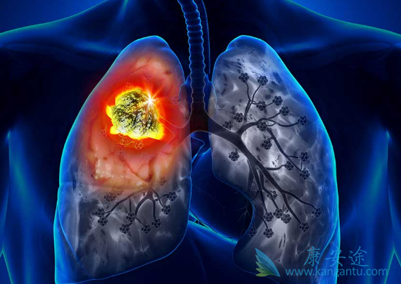 �ΰ�����