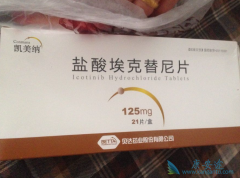 EGFR���Ƽ�����������ȫ�Է�������ĸ���Ч���ã�