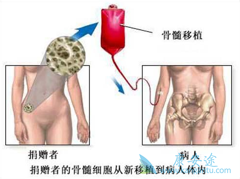 ��Ѫ��������ֲ