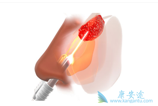 ���ʰ�����