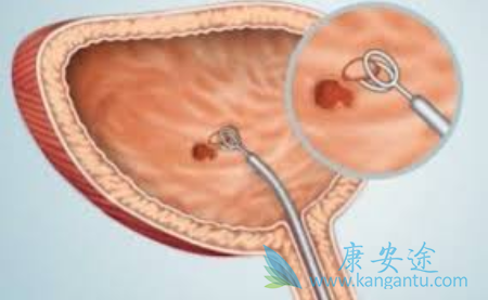 ���װ�������֢״