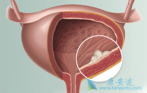 ���װ�������֢״