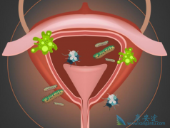 ���װ�����֢״������Ҫ����Щ��