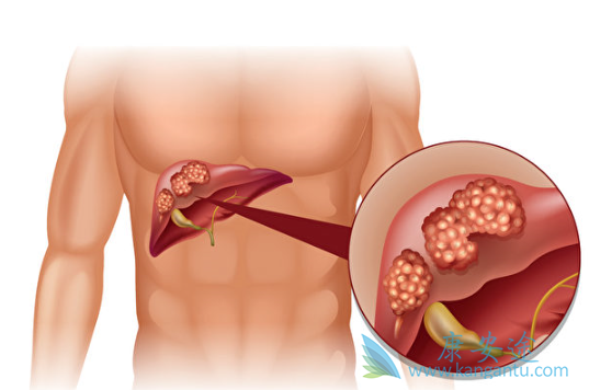 �ΰ����κ���