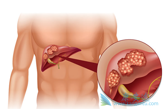 ���Ӱ�������