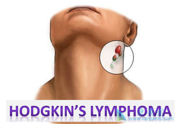 �ǻ�����ܰ���