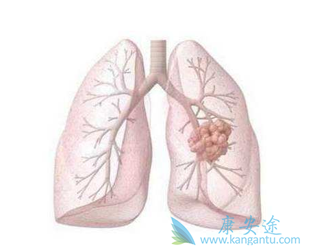 ��Сϸ���ΰ�