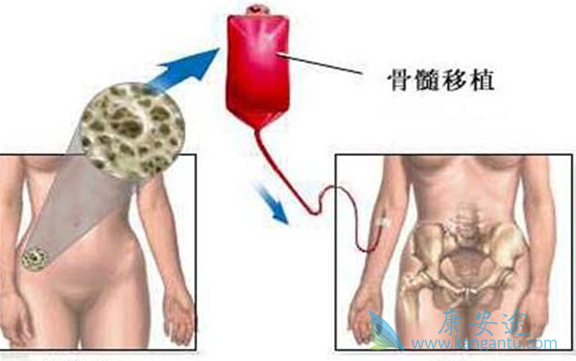 ��Ѫ��������ֲ