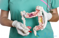 ��ɳ�����ڽ�ֱ������������ʲôȱ�㣿