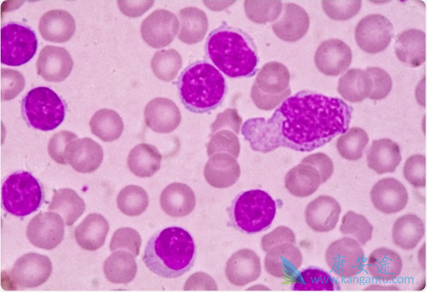 ��Ѫ����Ⱦ��