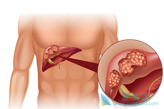 �ΰ���������