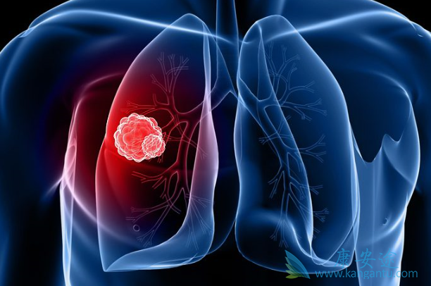 �ΰ�������