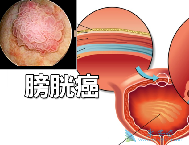���װ�����