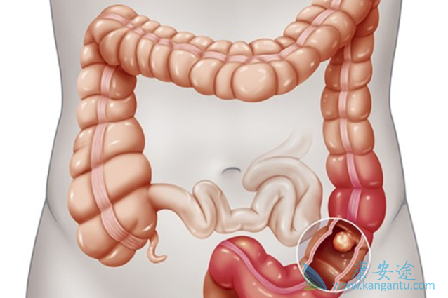 ��ֱ����