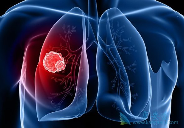 �ΰ�����