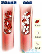 ������ϸ����Ѫ�����Ʒ�����ô���٣�