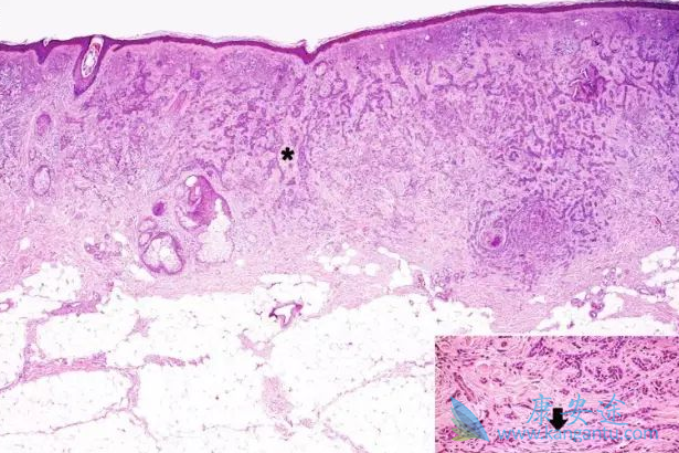 ����ϸ����